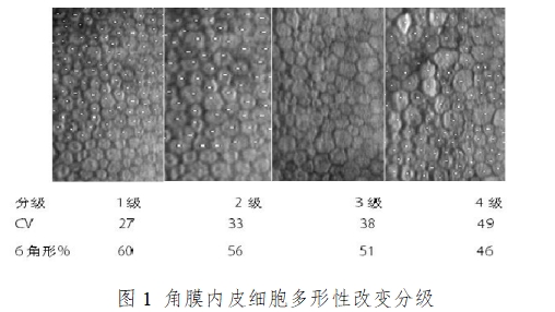 软性接触镜临床评价注册审查指导原则(2023年第33号)(图2) 软性接触镜临床评价注册审查指导原则(2023年第33号)(图2)
