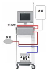 腹膜透析设备注册审查指导原则(2024年修订版)(2024年第19号)(图2) 腹膜透析设备注册审查指导原则(2024年修订版)(2024年第19号)(图2)