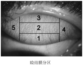 接触镜护理产品注册审查指导原则(2023年修订版)(2023年第9号)(图7) 接触镜护理产品注册审查指导原则(2023年修订版)(2023年第9号)(图7)