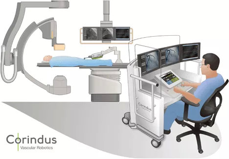 血管腔内介入手术机器人首例临床试验案例及未来发展方向(图2) 血管腔内介入手术机器人首例临床试验案例及未来发展方向(图2)