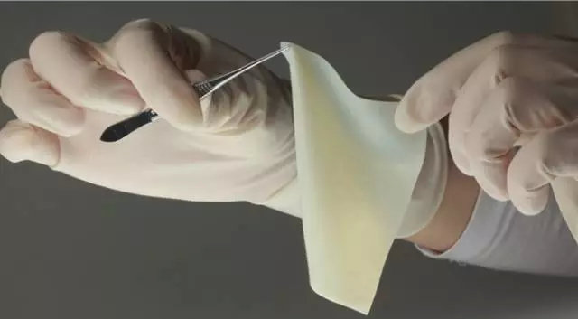 可吸收高分子材料介绍及其在植入医疗器械中的应用(图9) 可吸收高分子材料介绍及其在植入医疗器械中的应用(图9)